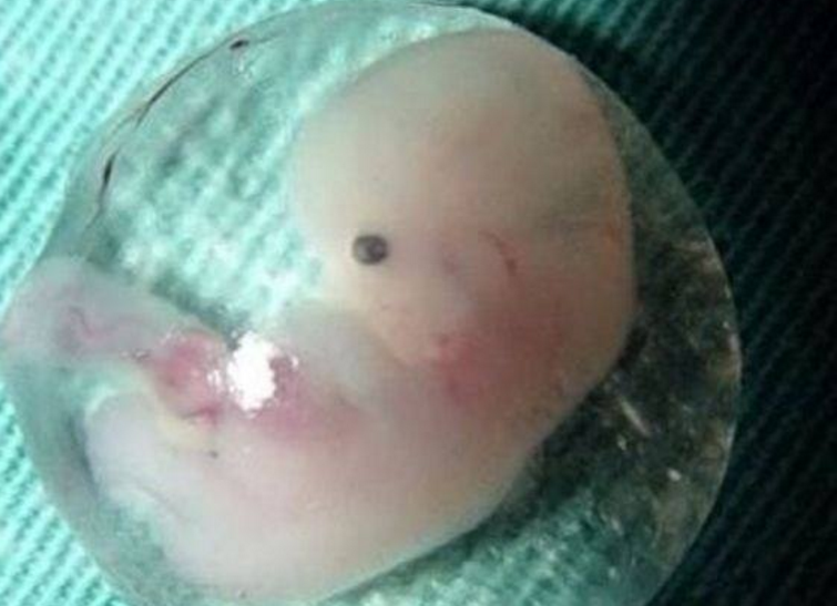 怎麽才能懷孩子 女人怎麽才能懷孩子